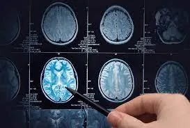 Medical image enhancement using GANs